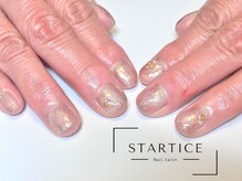 スターチス(STARTICE)/定額シンプルコース