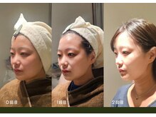 アン 銀座(ann)/#レモンボトル