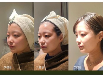 アン 銀座(ann)/#レモンボトル