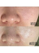 サロンドジェシカ(salon de Jessica)/プラズマ