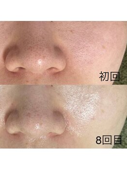 サロンドジェシカ(salon de Jessica)/プラズマ
