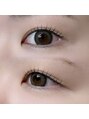 アミーナ 岐阜(Amina.) 瞼の状態もしっかり確認します!