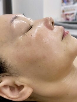 ダノンナ(Da Nonna relaxation house)の写真/【お肌にいいものだけを◎】レチノールは刺激が強すぎた…そんなあなたへ♪進化版「バクチオール」使用☆