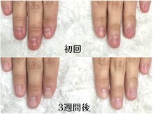 グラシナ 鳥丸店/乾燥は大敵です