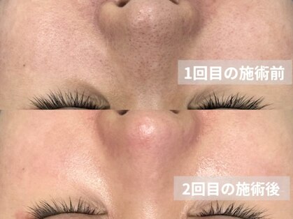 ユネ(une)の写真