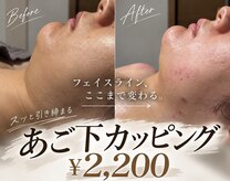 エクラ(eclat)