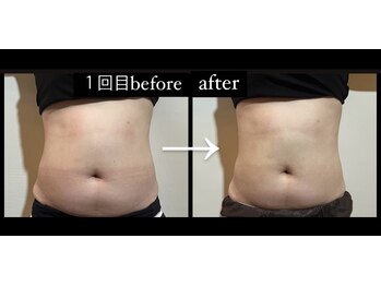 フェアリー/デトックス痩身・EMS(各部位)