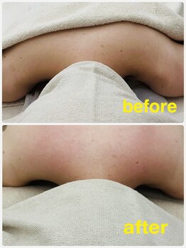 アールボディバランス/巻き肩・歪みを調整します!