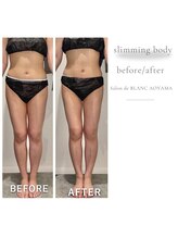 サロン ド ブラン アオヤマ(Salon de BLANC AOYAMA)/夏に向けて！スリミングボディ