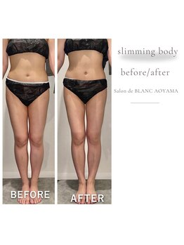 サロン ド ブラン アオヤマ(Salon de BLANC AOYAMA)/夏に向けて!スリミングボディ