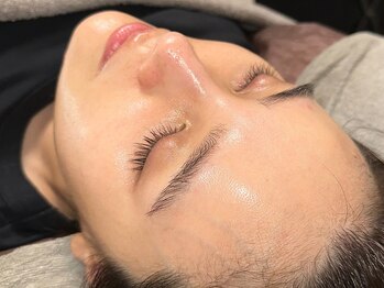 レイル(REIR)の写真/毛穴の汚れを丁寧に取り除き、透明感のある美しいお肌へ♪【純粋レチノールピール¥16,500→初回¥13,000】