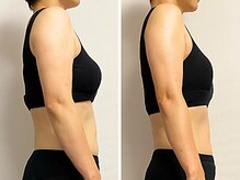 リンド(Lindo)/筋膜リリース