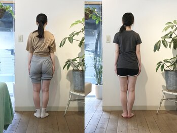 松山美容整体院/O脚矯正・美脚矯正