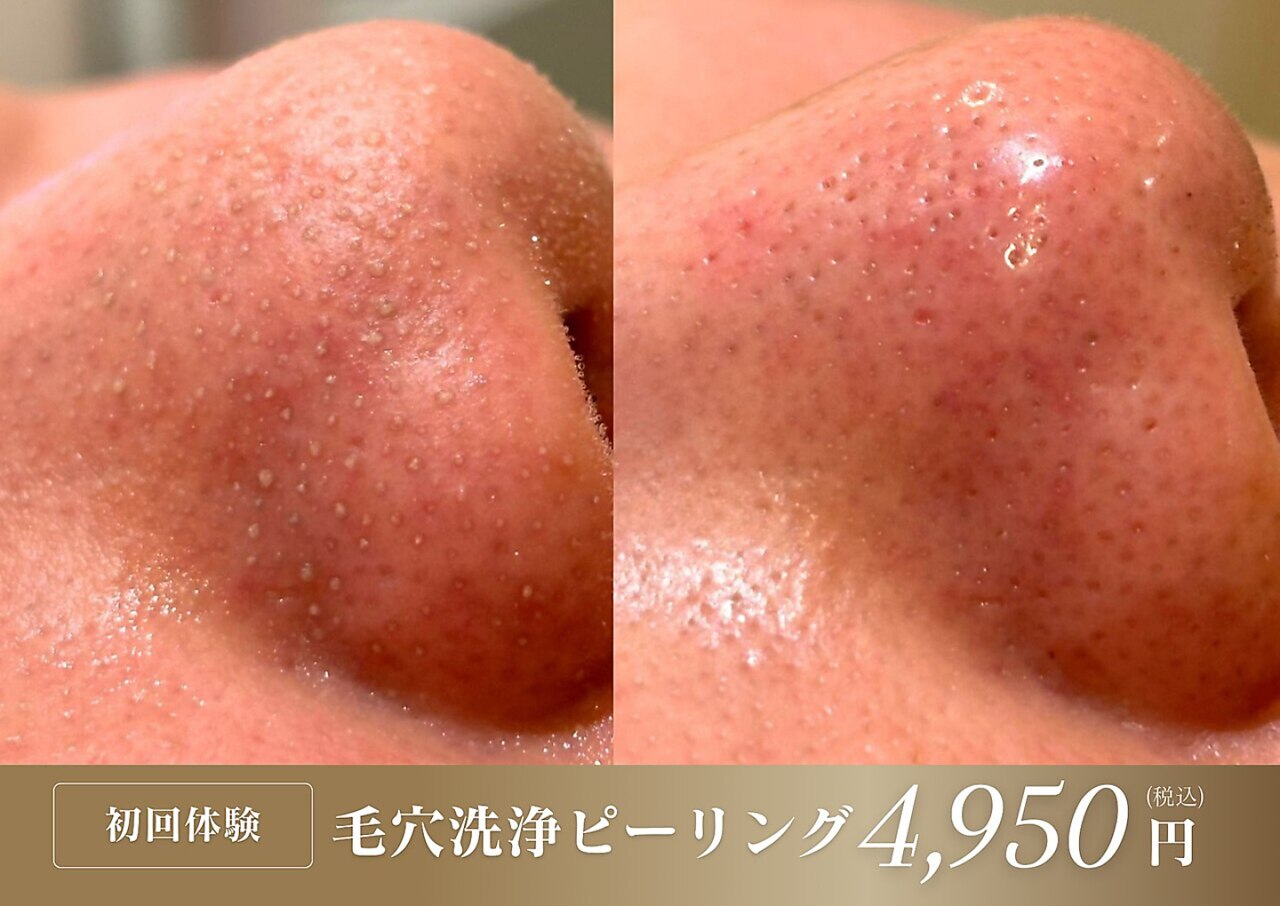 ツツイ｜ホットペッパービューティー