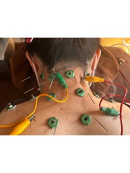 首・肩のつらさを改善したい