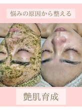マーリエ(Malie)/陶肌トリートメント