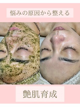 マーリエ(Malie)/陶肌トリートメント