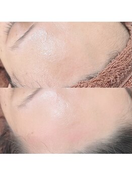 ユー アイズ(u eyes)/フェイスワックス