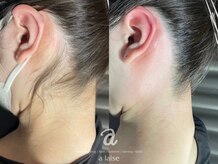 ア レーズ(a laise)