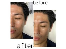 眉毛男子 新宿店/お客様の施術例【新宿店】