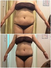 フォルティシモ ビューティ リラックス/小顔／エステ／お腹/ダイエット