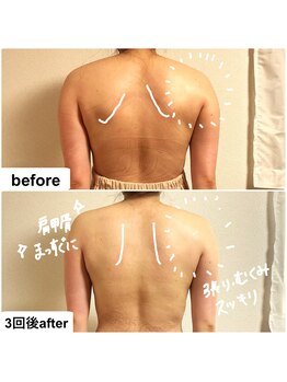 つばききよら/3回で肩回り、肩甲骨が変化！