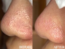 サロン ムスブ(salon MUSUBU)/山梨エステ/甲府エステ