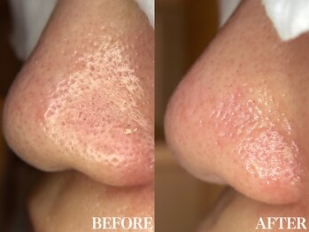 サロン ムスブ(salon MUSUBU)/山梨エステ/甲府エステ