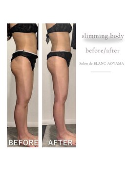 サロン ド ブラン アオヤマ(Salon de BLANC AOYAMA)/夏に向けて!スリミングボディ