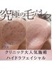 毛穴黒ずみニキビケア】美容機関大人気♪ 毛穴洗浄ハイドラフェイシャル8900
