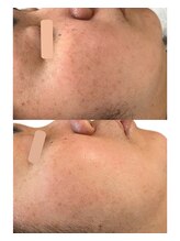 フロート(float)/