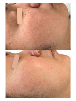 フロート(float)/