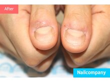 ネイルカンパニー/