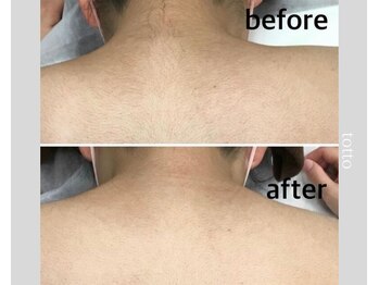 サロントット(salon totto)/before→after