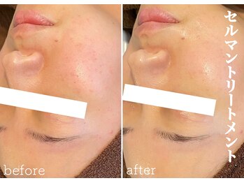モノ(MONO)/【セルマントリートメント】