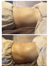 ヴァローレ(valore)/ガス溜り改善/ヘッドスパ