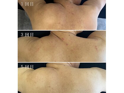 ラペカ(Lapeca)の写真