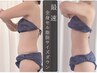 【本格全身痩身】セル脂肪&余分な脂肪徹底撃退（お腹&背中&腰&お尻or脚前後）