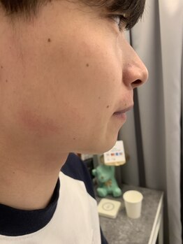 キレピア 新市街店(kirepia)の写真/「第一印象は肌で決まる。」清潔感アップ！メンズ光フェイシャルで、くすみ・毛穴・肌荒れを徹底ケア