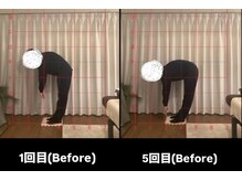 リリス(Lylis)/お客様ビフォー/アフター