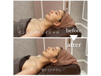 ナルシス(Narcissus)/インディバbefore→after