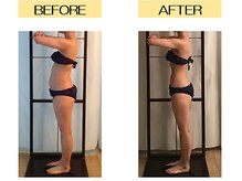 骨盤・筋膜矯正で姿勢も◎痩身も◎見た目が変わる圧倒的な技術力