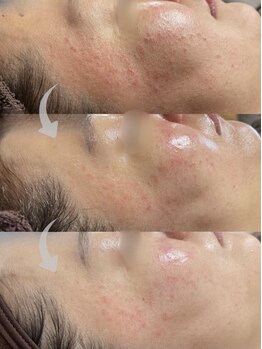 コア(Coeur)/lamination peeling