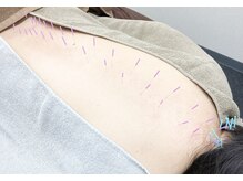 サボテン鍼灸マッサージ院