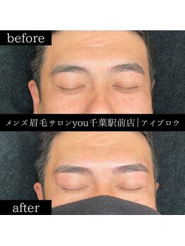 ユー 千葉駅前店(you)/ビフォ－アフター写真