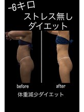 痩身・脱毛専門CLEA【クレア】/体重減少ダイエット