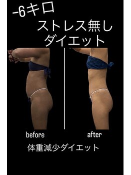 痩身・脱毛専門CLEA【クレア】/体重減少ダイエット