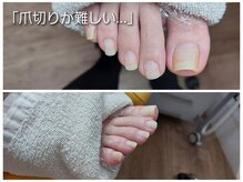 爪切り屋 足楽/トラブルが無くても・・・