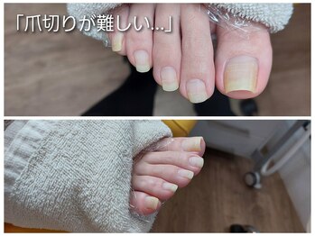 爪切り屋 足楽/トラブルが無くても・・・
