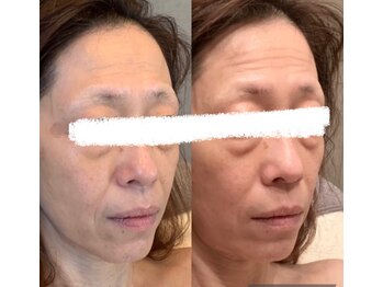 シベル(Si Belles)/50代半ば/1回目の結果